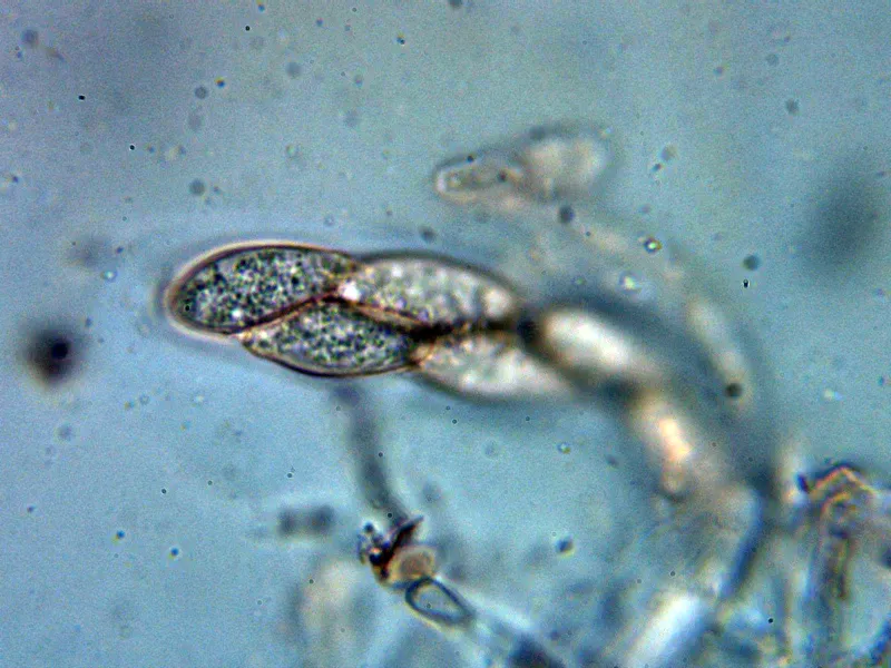 Botryosphaeria dothidea 10 - Asca 2